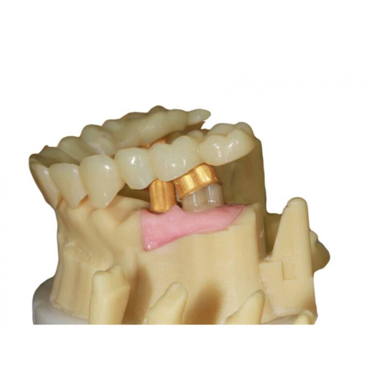 3D Drucker DLP Resin - Druckwege - Dental